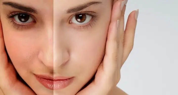 2.2. Hydroquinone