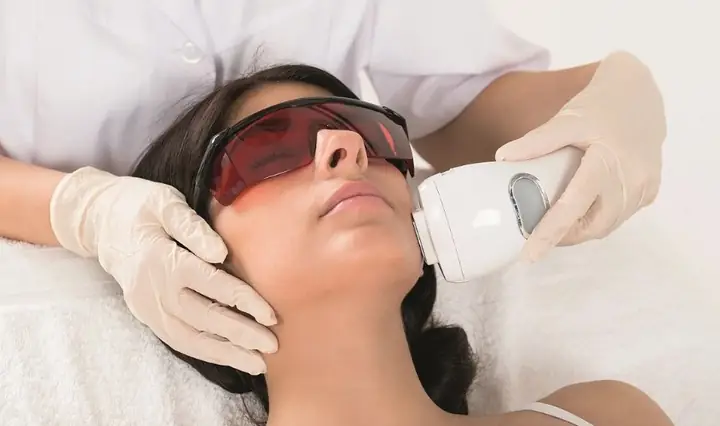 6.2. Tẩy lông bằng laser