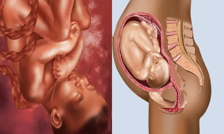 Thai nhi 33 tuần 5 ngày phát triển như thế nào? Thai nhi 33 tuần 5 ngày phát triển như thế nào?