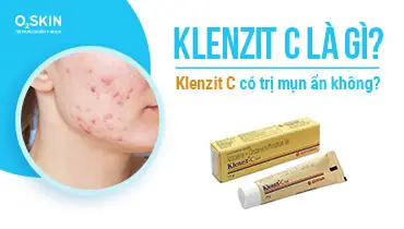 thuốc trị mụn ẩn dưới da
