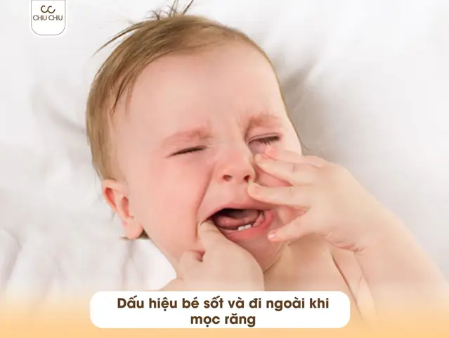 Trẻ Mọc Răng Bị Sốt và Đi Ngoài: Nguyên Nhân, Dấu Hiệu và Hướng Dẫn Xử Lý