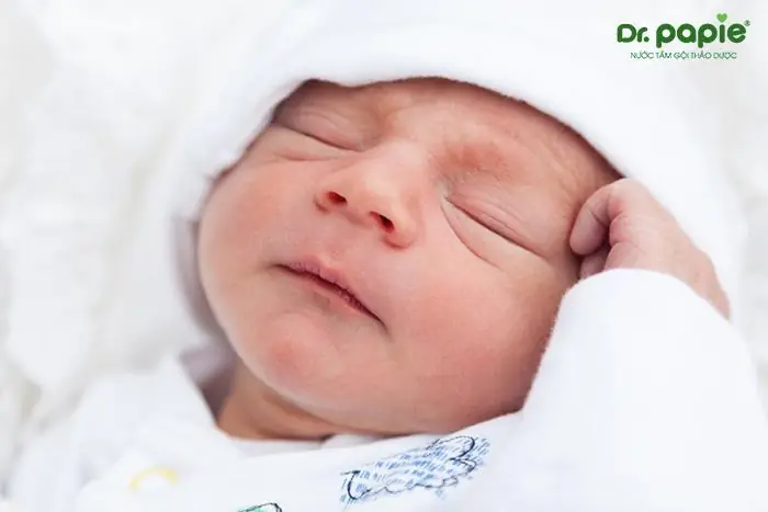 4. 3 lưu ý quan trọng khi bé sơ sinh bị mụn sữa trên đầu