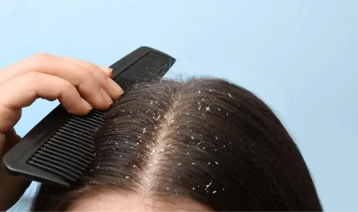 1Tác dụng của việc ủ tóc bằng sữa chua