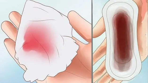1. Lý do vì sao sau khi sinh sản dịch hết rồi lại ra máu tươi?